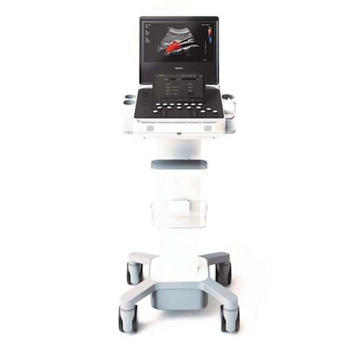 Ultrasound Philips 5300 Series